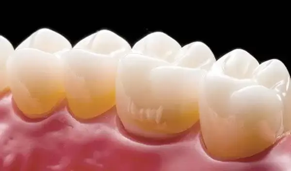 FULL CONTOUR ALL-TRANSLUCENT