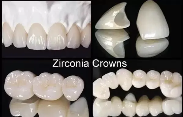 Zirconia dental crown benefits