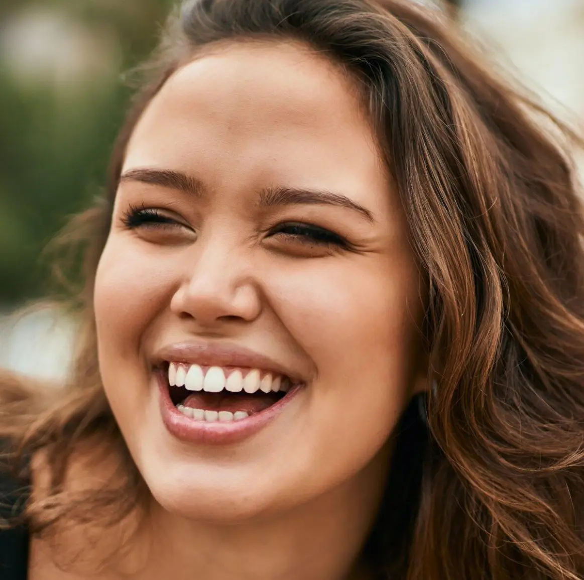 Smiling Woman Dental Result